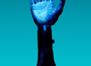 alt="Free Prosthetic Arm on Blue Background Stock Photo"